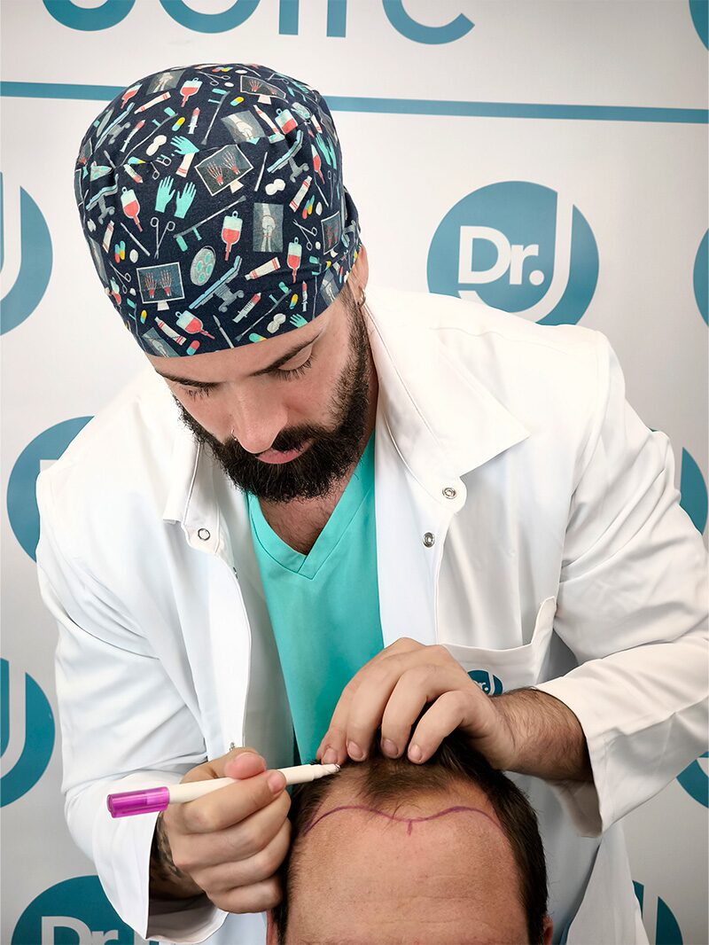 Dr. Jofré marcando la línea capilar antes de la intervención
