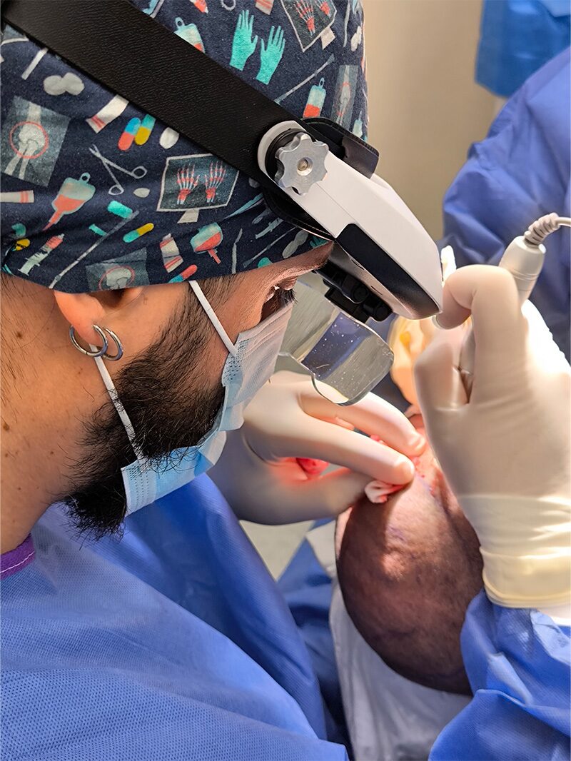 Microscopía durante la extracción folicular FUE