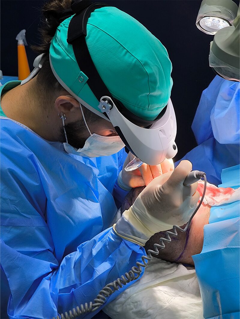 Magnificación quirúrgica para precisión folicular